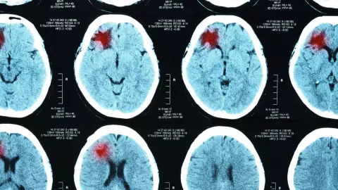 จริงไหม กินเหล้าแล้ว ห้ามเลือดยาก อันตรายจนหมอต้องเตือน