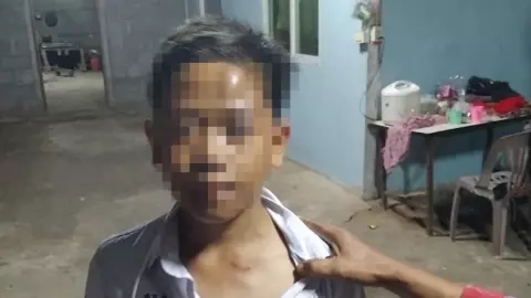 เด็กชาย ป.6 ร้องไห้หาปู่ ฟ้องครูทุบหัวปูด เหตุเตะตะกร้อในห้องคอมพ์