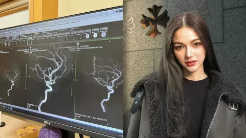 กวาง เดอะเฟซ ปวดไมเกรน น้ำหนักลดฮวบ 4-5 กก. อาการเพียบจนต้องตรวจ MRA