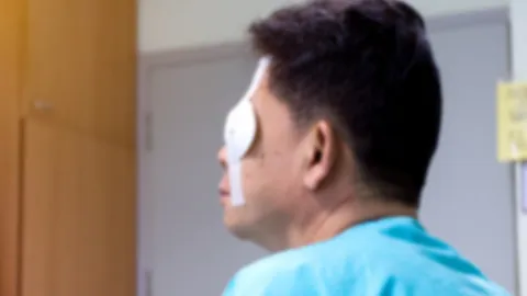 จักษุแพทย์ เตือนจริงจัง อย่าผสม "โซดาไฟ" กับสารอื่น เสี่ยงระเบิดใส่ตาบอด