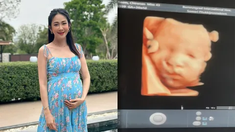 นางเอกดังเผยภาพอัลตราซาวนด์ รู้เลยลูกใคร ตื่นเต้นจะได้เจอหน้ากันแล้ว