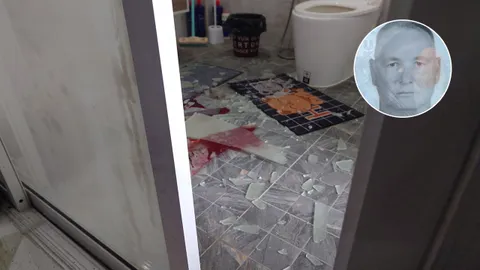 นักธุรกิจอังกฤษ เดินล้มใส่ประตูบานเลื่อน กระจกบาดอกเหวอะดับสยอง