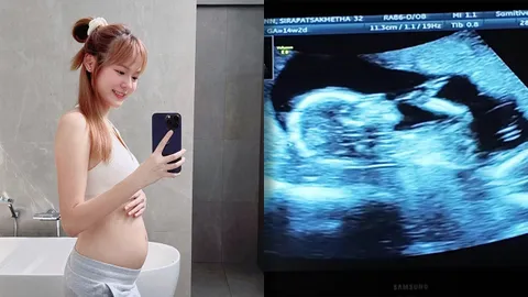 แดน-แพทตี้ เฉลยเพศลูกแฝดพร้อมภาพอัลตราซาวนด์ แฮปปี้ได้สมดังใจหวัง (คลิป)