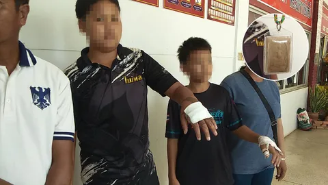 หลวงปู่ลองพระสมเด็จฯ ราดน้ำกรดลวกมือเด็ก พ่อแจ้งตำรวจเอาเรื่อง