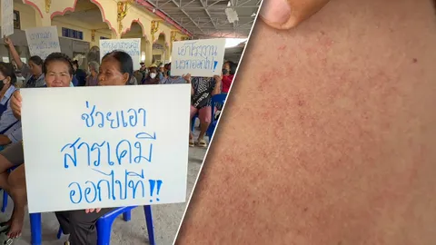 คนระยองผื่นขึ้นตามตัว วอนนายกรัฐมนตรี เร่งขนย้ายสารเคมีโดยเร็ว