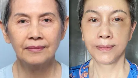 ส่องหน้าใหม่นักแสดงรุ่นใหญ่หลังศัลยกรรม ไม่น่าเชื่ออายุขึ้นเลข 7 แล้ว