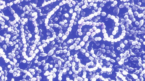 เตือน โรคแบคทีเรียกินเนื้อ กำลังระบาดในญี่ปุ่น พบผู้ป่วยพุ่ง ทุบสถิติ