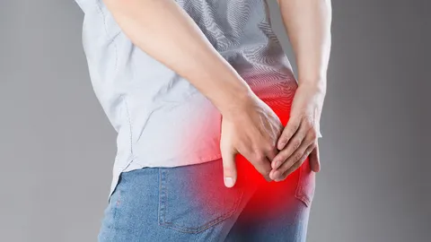 5 วิธีรักษาริดสีดวงด้วยตัวเองแบบง่ายๆ แค่ปรับพฤติกรรม ก็ป้องกันได้