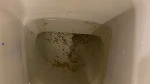 ลูกบ้านคอนโดร้อง ติดเชื้อปรสิตในน้ำ ทำคนตาแดงนับร้อย บางรายหวิดตาบอด