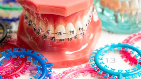 ห่วงจัดฟันแฟชั่นหมอเถื่อนเสี่ยงติดเชื้อถึงชีวิต