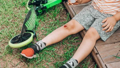 แผลเล็กอย่ามองข้าม แบคทีเรียกินเนื้อคน ภัยเงียบที่อันตรายถึงชีวิต