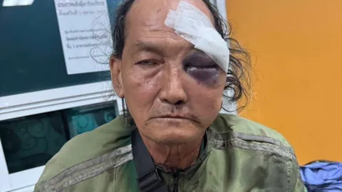 ลุงไรเดอร์ วัย 64 ถูกชาย 2 คนจัดฉากชนท้ายรถ สบโอกาสชกหน้าหงายแล้วชิงเงินหนี