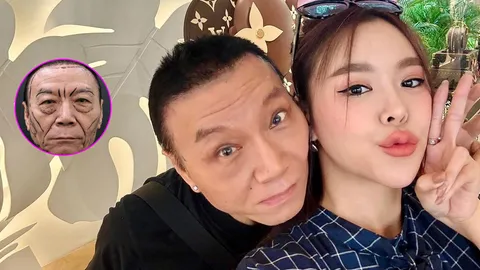 ซานิ พาพ่อขึ้นเขียงทำศัลยกรรมดึงหน้า ตะลึง 1 เดือนเปลี่ยนแปลงไปมาก 