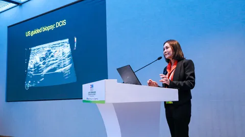 BDMS พัฒนากระบวนการคัดกรองมะเร็งเต้านม ใช้ AI เสริมการวินิจฉัยให้ผลแม่นยำขึ้น