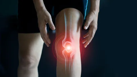 “ข้อเข่าเสื่อม” รักษาหายได้ ไม่ต้องทนเจ็บ