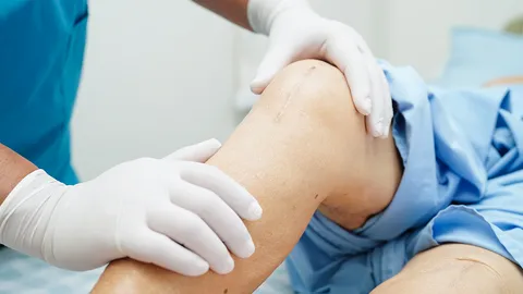 “ศิริราช” เปลี่ยนข้อเทียมผู้ด้อยโอกาส สานปี 68 คาดเป็นประเทศเพื่อนบ้าน