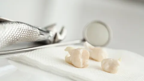 รพ. แจงแล้ว กรณี "หญิงฉะเชิงเทรา" ถูกถอนฟันกราม 8 ซี่ รักษามะเร็งต่อมทอนซิล