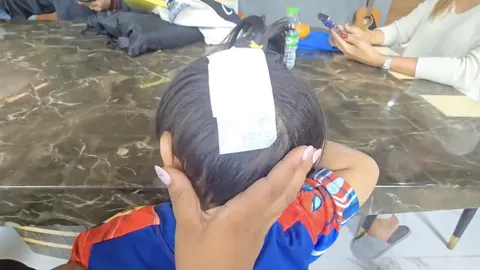 แม่ร้อง ลูกชายวัย 3 ขวบ ถูกสุนัขพันธุ์บางแก้วกัดหัว เจ้าของปัดรับผิดชอบ