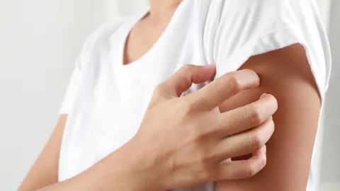 เตือนผู้สูงวัยเสี่ยงป่วยโรคงูสวัด แพทย์เตือนควรฉีดวัคซีนก่อนเกิดอาการรุนแรงและภาวะแทรกซ้อน