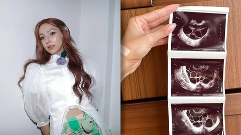 คารีสา เปิดภาพอัลตราซาวนด์ สุดแฮปปี้ฝากไข่สำเร็จ 27 ใบ (คลิป)