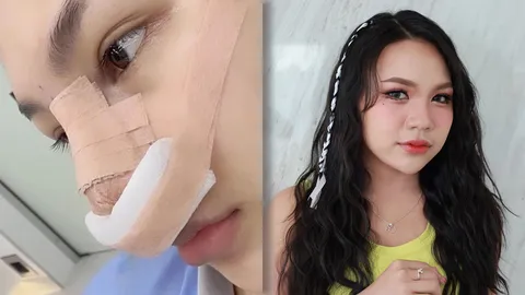 สวยแน่นอน ลิลลี่ ได้หมดถ้าสดชื่น ขึ้นเขียงทำจมูกใหม่ รอลุ้นความปังได้เลย