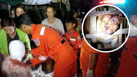 พิตบูลขย้ำเด็ก