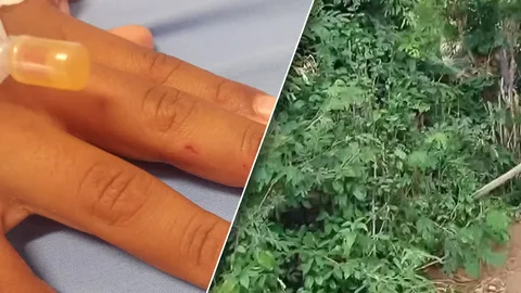 แม่แชร์อุทาหรณ์ ลูกวัย 7 ขวบ เล่นซ่อนหาแถวพุ่มไม้รก สุดท้ายเจองูมีพิษฉกมือ