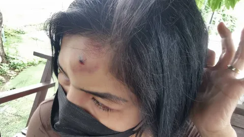 สาวโดนซ้อมน่วม แจ้งความคนรักวัย 39 โอดทำอะไรก็ผิด กินกับข้าวเยอะก็โดนตบ