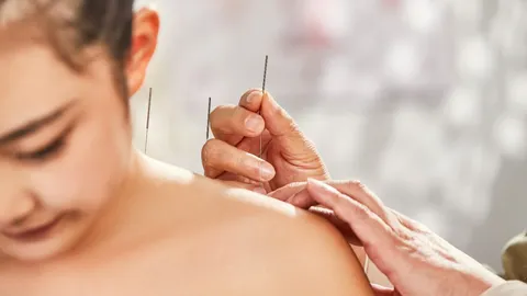 ฝังเข็มลดปวด ทางเลือกของการรักษาออฟฟิศซินโดรม