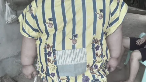 สุดเศร้า "น้องภูมิ" เด็กชายออทิสติก ป่วยโรคอ้วน เสียชีวิตแล้ว