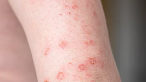 อัปเดตพิกัดตรวจโรคซิฟิลิส 2568 ทั่วกรุงเทพมหานคร 