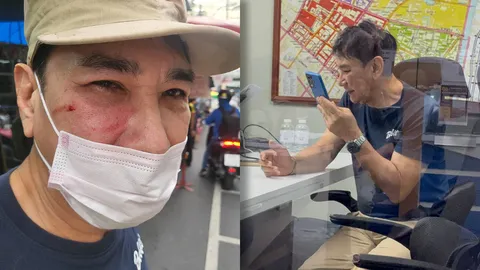 เปิดสาเหตุ "ทูน หิรัญทรัพย์" ถูกขาใหญ่ย่านคลองถมทำร้ายร่างกาย 