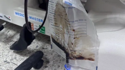 วิจารณ์ยับ ครูลงโทษนักเรียนสั่งลุกนั่ง 200 ครั้ง สุดท้ายไตวาย ปัสสาวะเป็นสีโค้ก