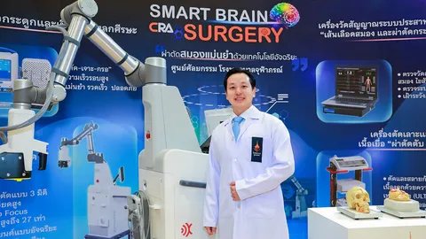 โรงพยาบาลจุฬาภรณ์ เปิดตัวหุ่นยนต์ผ่าตัดสมอง