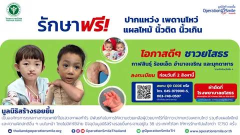 มูลนิธิสร้างรอยยิ้ม ร่วมกับโรงพยาบาลยโสธร จัดโครงการสร้างรอยยิ้ม ผ่าตัดฟรี!!