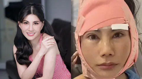 แก้ว อภิรดี เปิดภาพล่าสุดหลังศัลยกรรมหน้า 2 เดือน แฟนๆ แห่ชมสวยใสหน้าเด็กลง