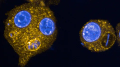 แอริโซนาพบผู้เสียชีวิตจาก “กาฬโรคปอด” ยืนยันความเสี่ยงต่อสังคมต่ำ