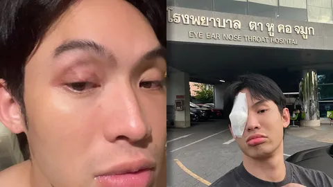 ดีเจมะตูม เล่าบทเรียนราคาแพง แค่คันตา แต่ไม่ยอมไปหาหมอสุดท้ายเป็นหนักกว่าเดิม!!