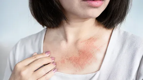 วงจรคันคะเยอ เอาแต่เกา เกาดีมั้ย? (ตอน 2)