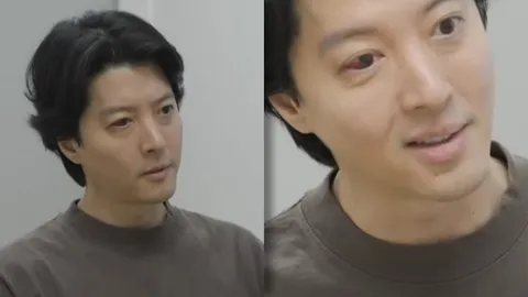 อีดงกอน พระเอกเกาหลี ป่วยตาแดงและเจ็บปวด แพทย์เผยเป็นโรคหายากที่พบแค่ 1%