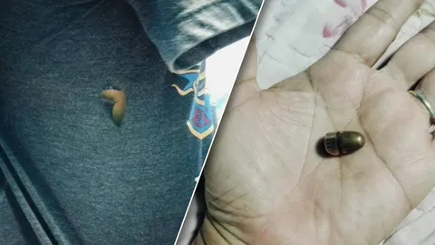 หนุ่มวัย 19 ถูกกระสุนปริศนาพุ่งใส่ลำตัว ทะลุเสื้อขาดเป็นรู แต่มีแผลแค่รอยแดง