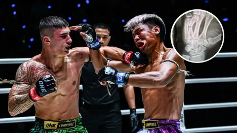 เป็นไปได้ไง "นักมวยอิตาลี" ต่อย "นักมวยไทย" มือหักตั้งแต่ยกแรก-ฝืนชกต่อจนจบไฟต์ (คลิป)