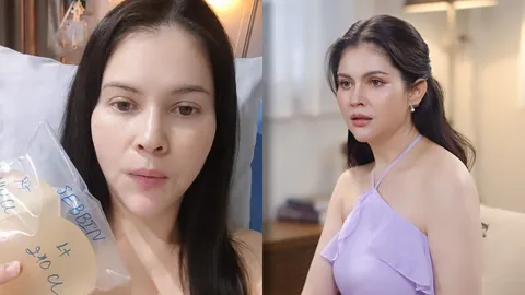 แอนนี่ บรู๊ค ผ่าตัดถอดซิลิโคนหน้าอกออก หลังอยู่ในตัวนาน 20 ปี พร้อมเผยเหตุผล