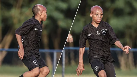 “เบอร์นาร์โด โลเปส” เด็กน้อยจากบราซิล ผู้รอดชีวิตจากไฟลวก สู่แข้งใหม่โบตาโฟโก