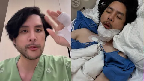 ทอม อิศรา เกือบหลับแต่กลับมาได้ เพราะสกู๊ตเตอร์ล้ม ซุ่มรักษาตัวมาเป็นเดือน 