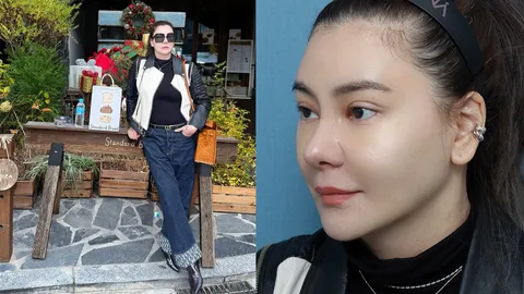 โอ๋ ภัคจีรา เปิดภาพล่าสุดหลังศัลยกรรมจมูกที่เกาหลี ดูสวยพุ่งแถมหน้าเด็กลง