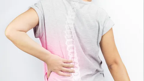 รู้จักโรคและภาวะที่เป็นปัจจัยเสี่ยงของ “โรคกระดูกพรุน” ตอนที่ 2