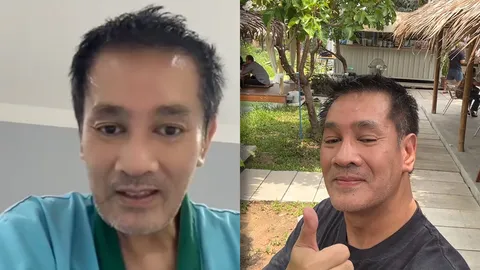 ต้น จักรกฤษณ์ ผ่าตัดถุงน้ำดีแบบเปิดหน้าท้อง เผยสาเหตุผ่าแบบส่องกล้องไม่ได้