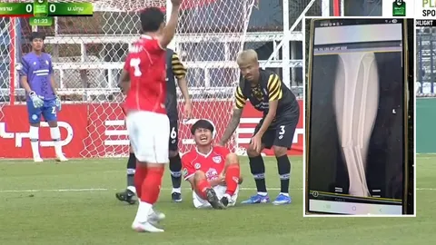 “ส.บอลไทย” ตัดสินใจแล้ว “นักฟุตบอล” เสียบคู่แข่ง “ขาหัก” (คลิป)