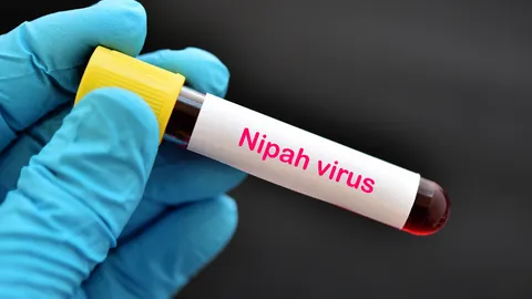 อินเดียเร่งสกัด "ไวรัสนิปาห์" พบผู้ติดเชื้อเพิ่ม 5 ราย สั่งกักตัวเฉียด 100 คน หวั่นระบาดรุนแรง